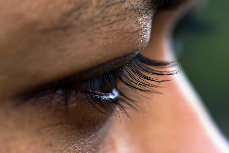 Eyes